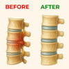 SmoothsSpine - Triple Fusion Massager